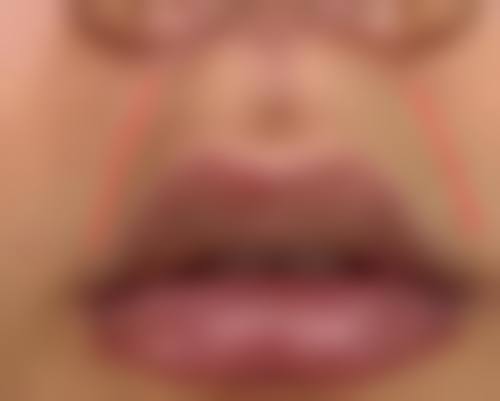 五、南方医 科 大学附属协和医院激光整形美容中 心怎么预约：