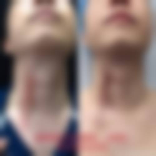 石春蕊医生口碑和评价