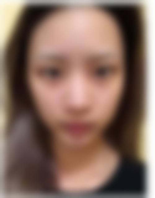 六、南方医 科 大学附属协和医院激光整形美容中 心价格表：（仅供参考）