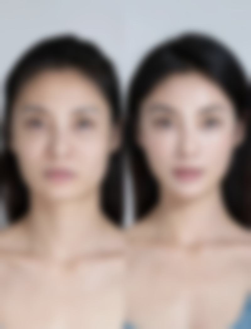 瘦身吸脂成效显著吗？术前术后注意保护成效