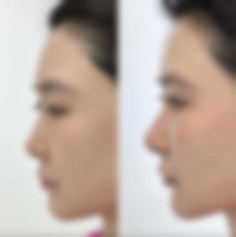 五、Honesty整形外科怎么预约：