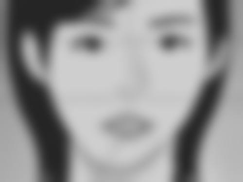 割双眼皮后后期出门及修复成效：完全修复前的出门注意事项