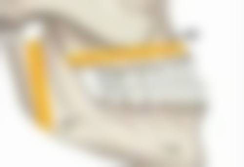 不同术式的眼部抽脂细节大揭秘