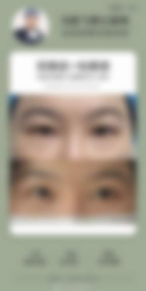 四、盐城顾泽潮聚医美整形中 心实例