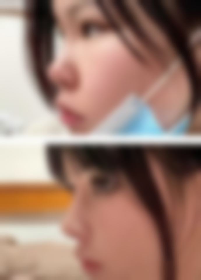 七、扬州华美医疗美容门诊部价格表：（仅供参考）