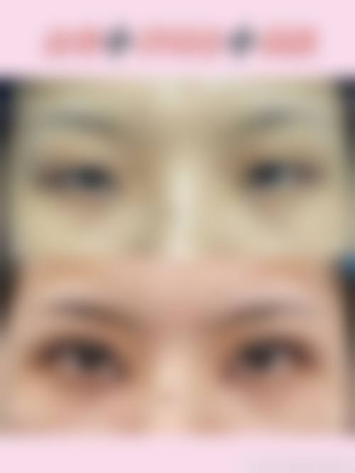 六、广州华晨壹美整形医院价格表：（仅供参考）