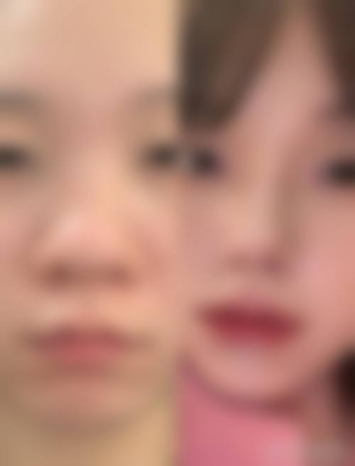 七、杭州维美医疗美容诊所价格表：（仅供参考）