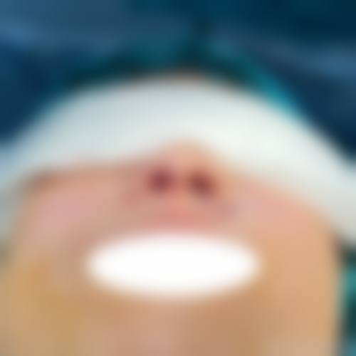 四、邢台张瑞君中医经络点穴医院整形科开展的主要项目和特色项目：