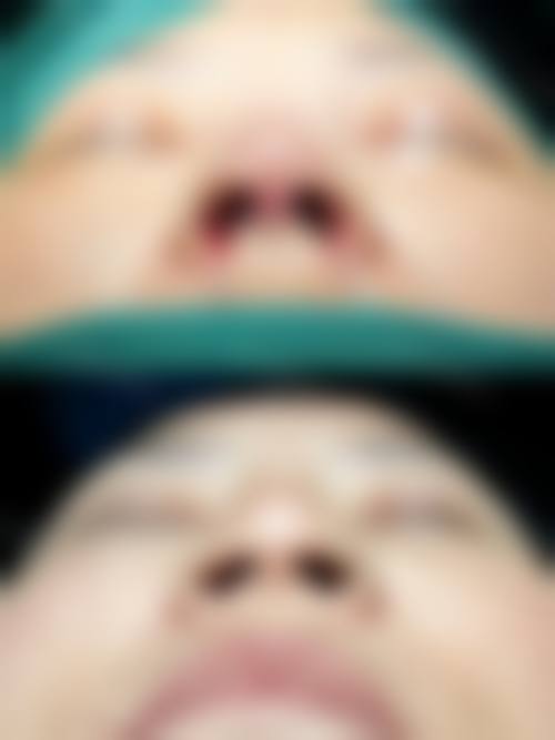 六、邢台张瑞君中医经络点穴医院整形科怎么预约：