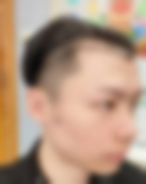 六、南通俪人连天美植发整形科怎么预约：