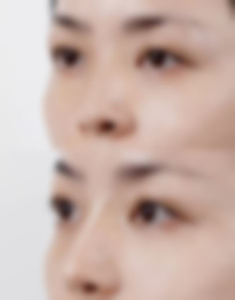 五、广州肤美美容医院实例