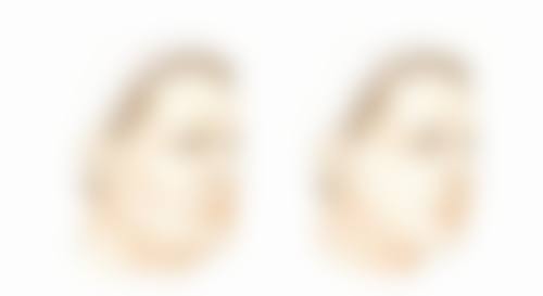 怎样让老疤痕修复？按摩护理不可少