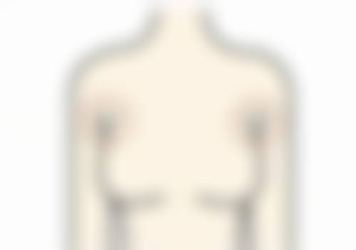 怎样让老疤痕理想修复？综合疗法成效佳