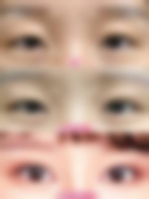 谢洪霞医生实例