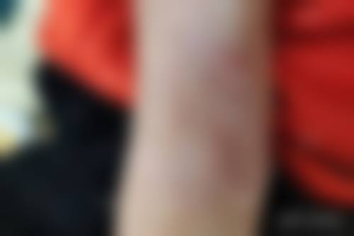 吴祖林医生怎么样可靠吗？