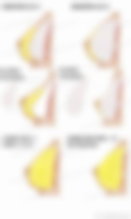 五、苏州恩美医疗美容实例