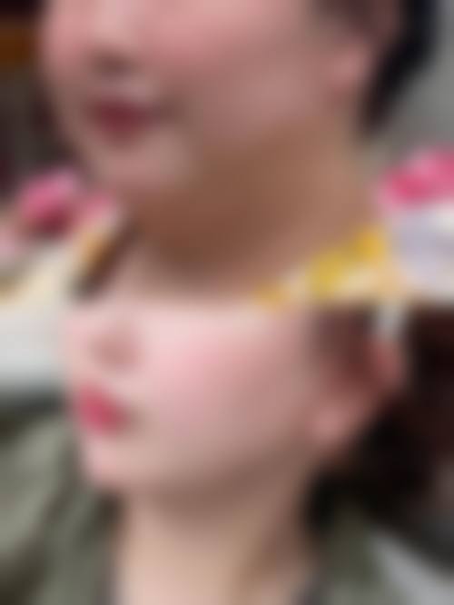 七、西安肆奢医疗美容诊所价格表：（仅供参考）