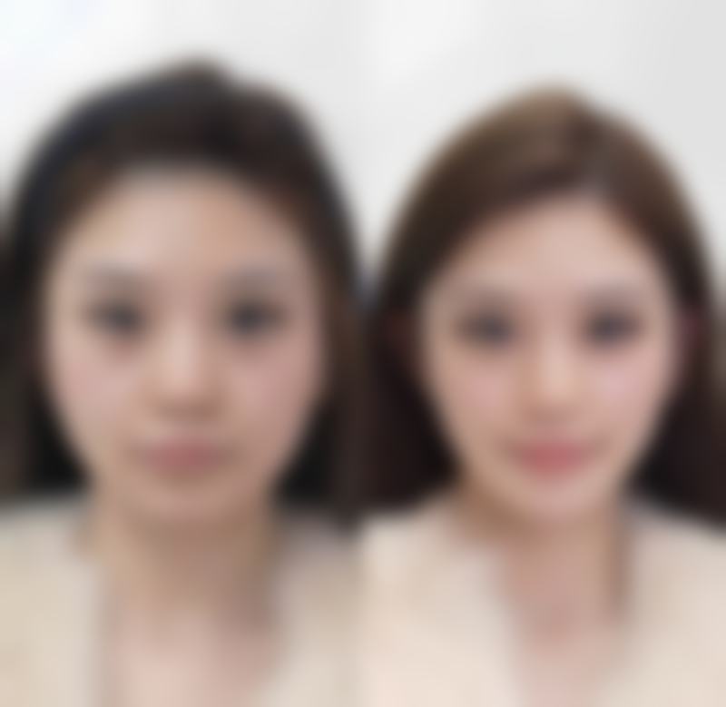 怎样让老疤痕淡化？专精产品显神通