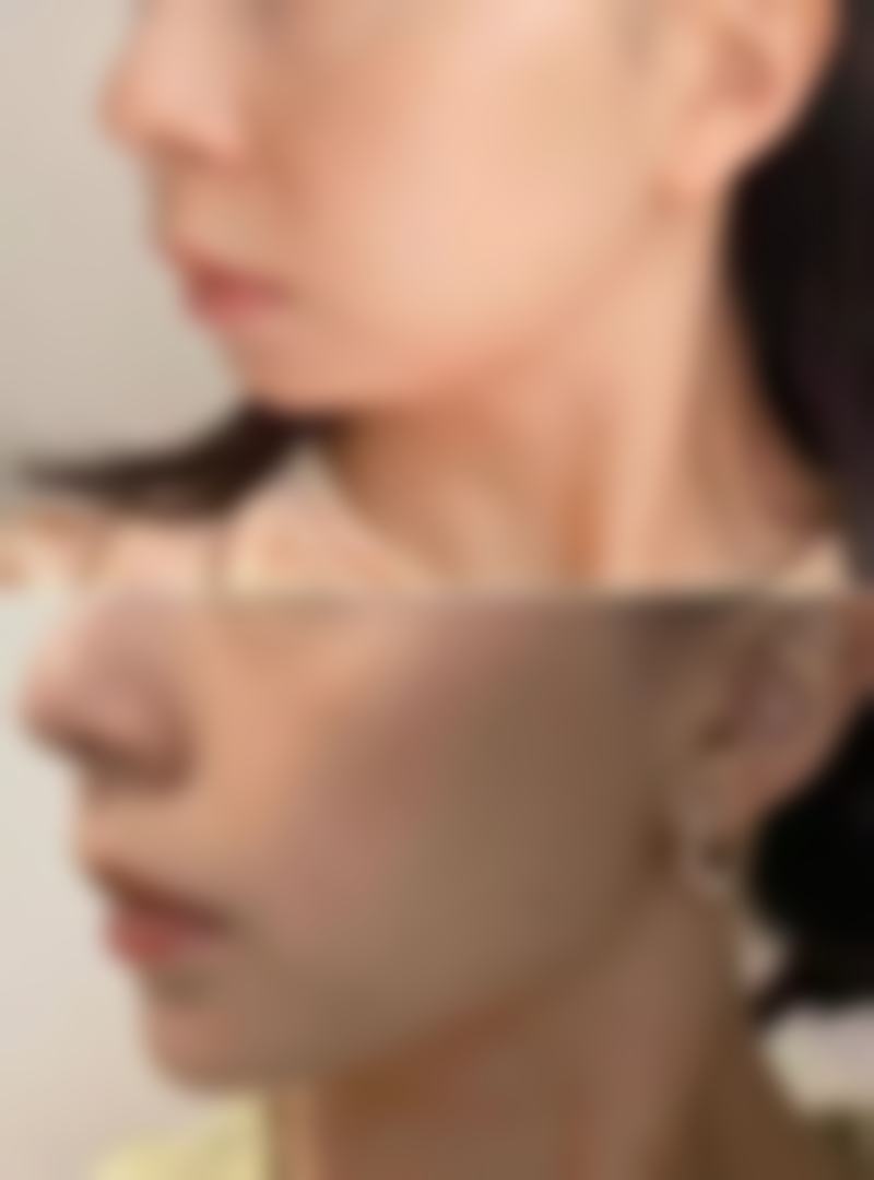 刘宝山医生实例