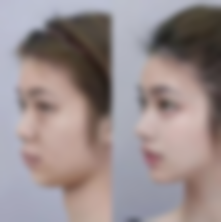 八、韩国拉菲安（LAVIAN）整形外科医院真实的顾客评价如下：