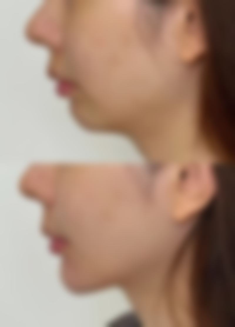 赵汉卿医生怎么样可靠吗？