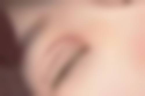 割双眼皮后吃草莓，促进修复有一套