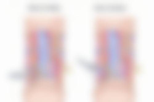 割双眼皮后吃草莓，注意事项要牢记