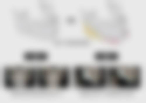 术后护理要点之活动与运动：循序渐进