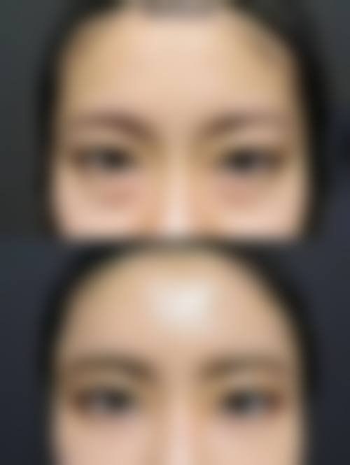 七、西安未央鼎欣晟唐医疗美容价格表：（仅供参考）