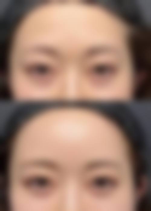 六、西安未央鼎欣晟唐医疗美容怎么预约：