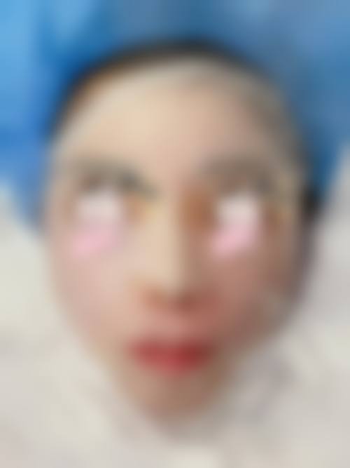 五、温州芬迪医美整形怎么预约：