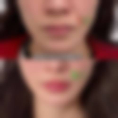 四、温州芬迪医美整形实例