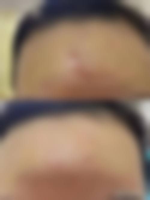 六、南通市中医院怎么预约：