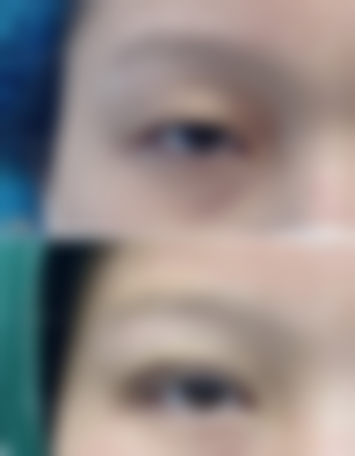 五、宁波雅韩宁悦医疗美容实例