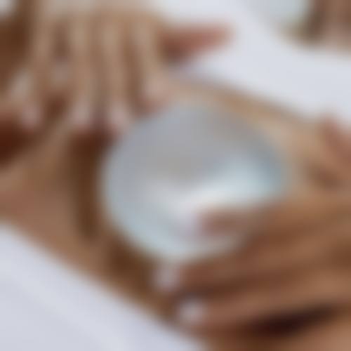 五、秦皇岛贝值整形医院实例