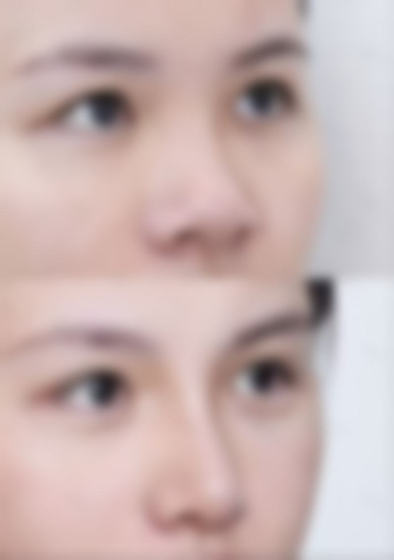 七、武汉德美整形医疗美容门诊部真实的顾客评价如下：