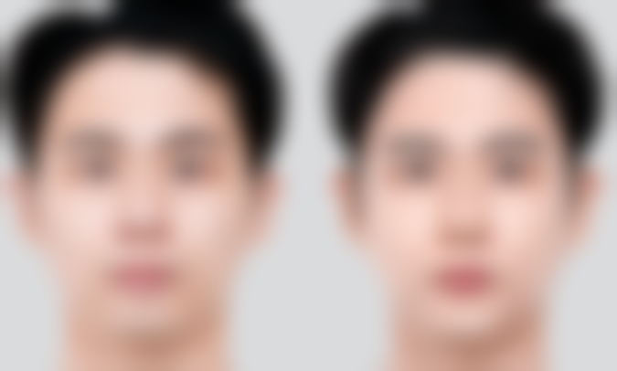 五、咸阳容悦芯容貌整形医院怎么预约：