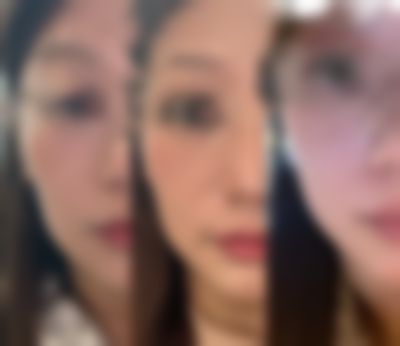 四、岳阳医菲洛医疗美容诊所实例