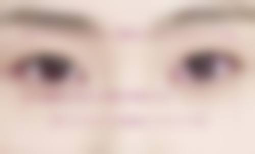 五、昆明陆庭芳整形美容诊所实例