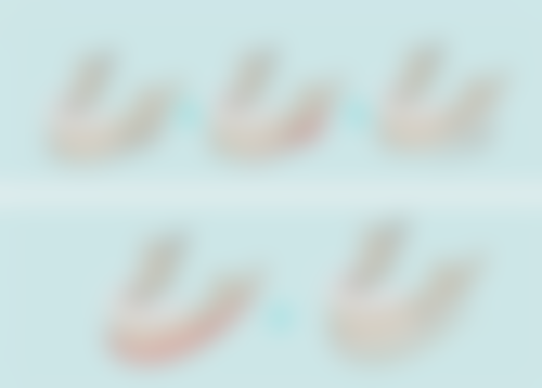 孩子手术留疤当兵：疤痕修复带来的机会