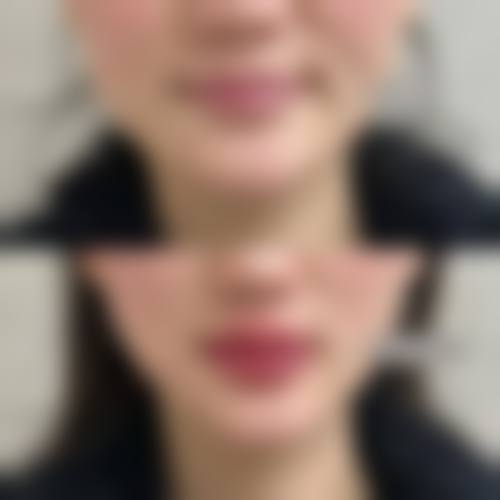 五、上海杨思医院整形美容医院怎么预约：