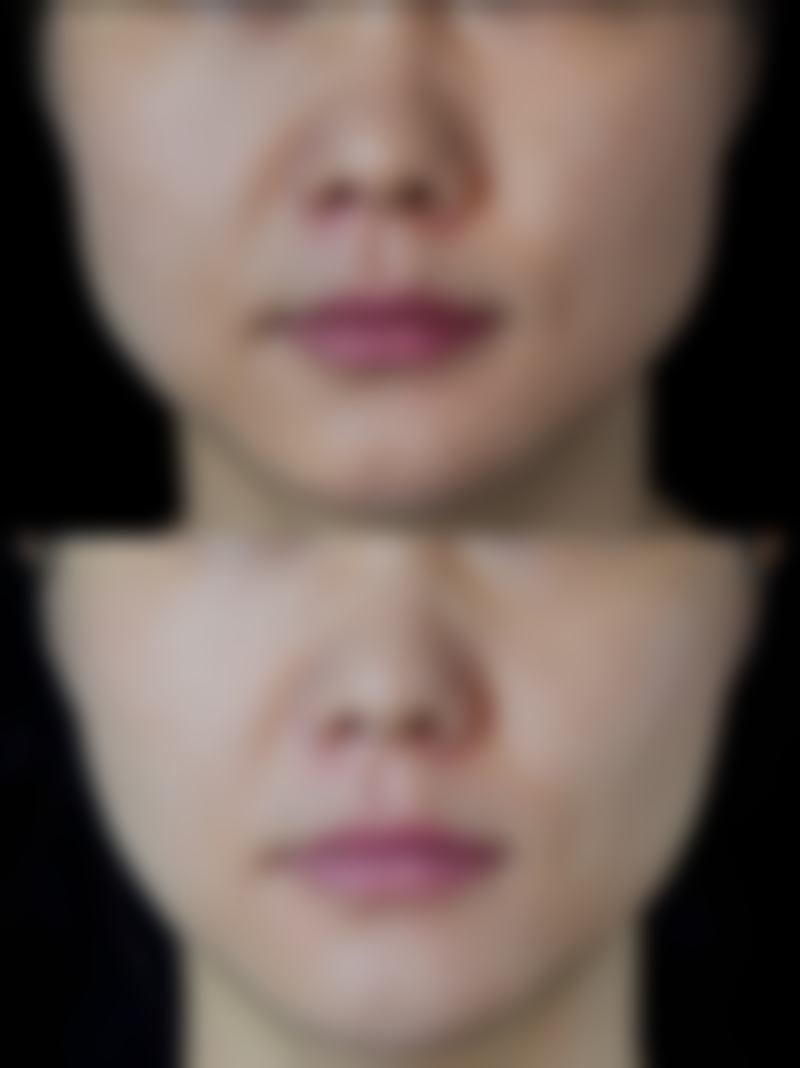 五、广州广美整形美容医疗门诊部实例