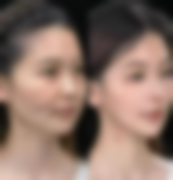 五、合肥申诚美容整形门诊部实例