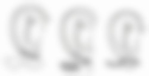 40岁女人告别顽固眼袋：医美手段显神通