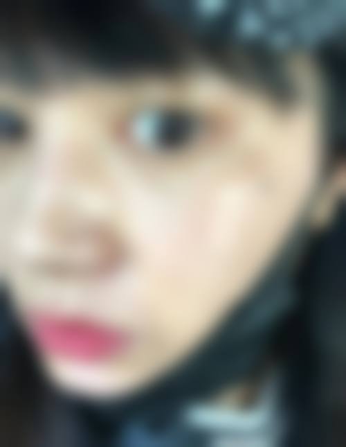 八、无锡苏朗肤整形医院真实的顾客评价如下：