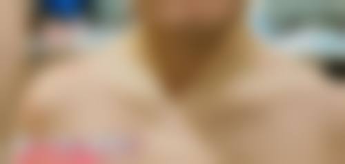 八、西安蔻华整形医疗美容诊所真实的顾客评价如下：