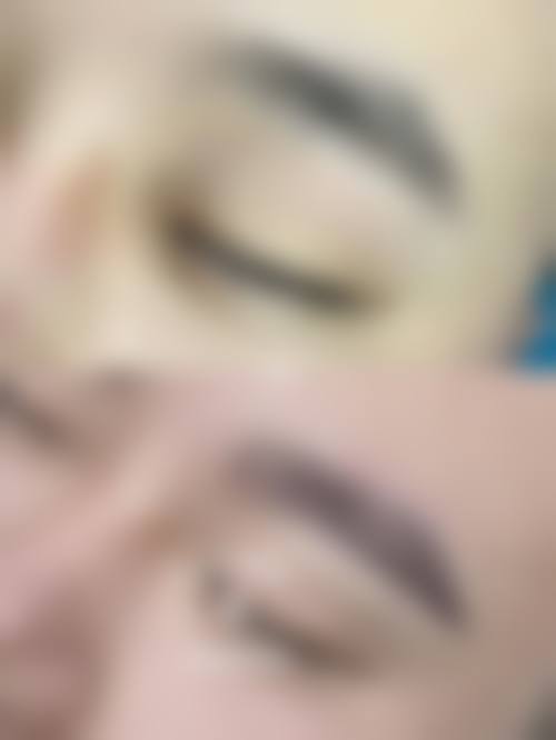 八、韩国永长（Woomchan）毛发移植医院真实的顾客评价如下：