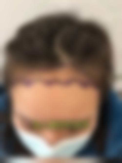 三、韩国永长（Woomchan）毛发移植医院医生介绍: