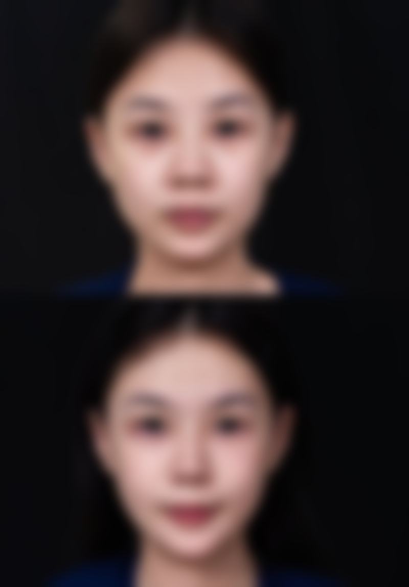 七、韩国Noblesse整形外科价格表：（仅供参考）