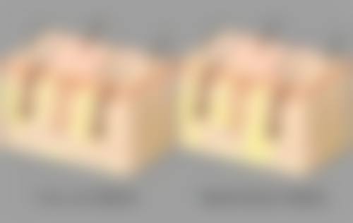 日常综合调理如何配合维生素E去眼袋？成效加倍